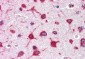 Goat Anti-ribosomal protein L8 Antibody